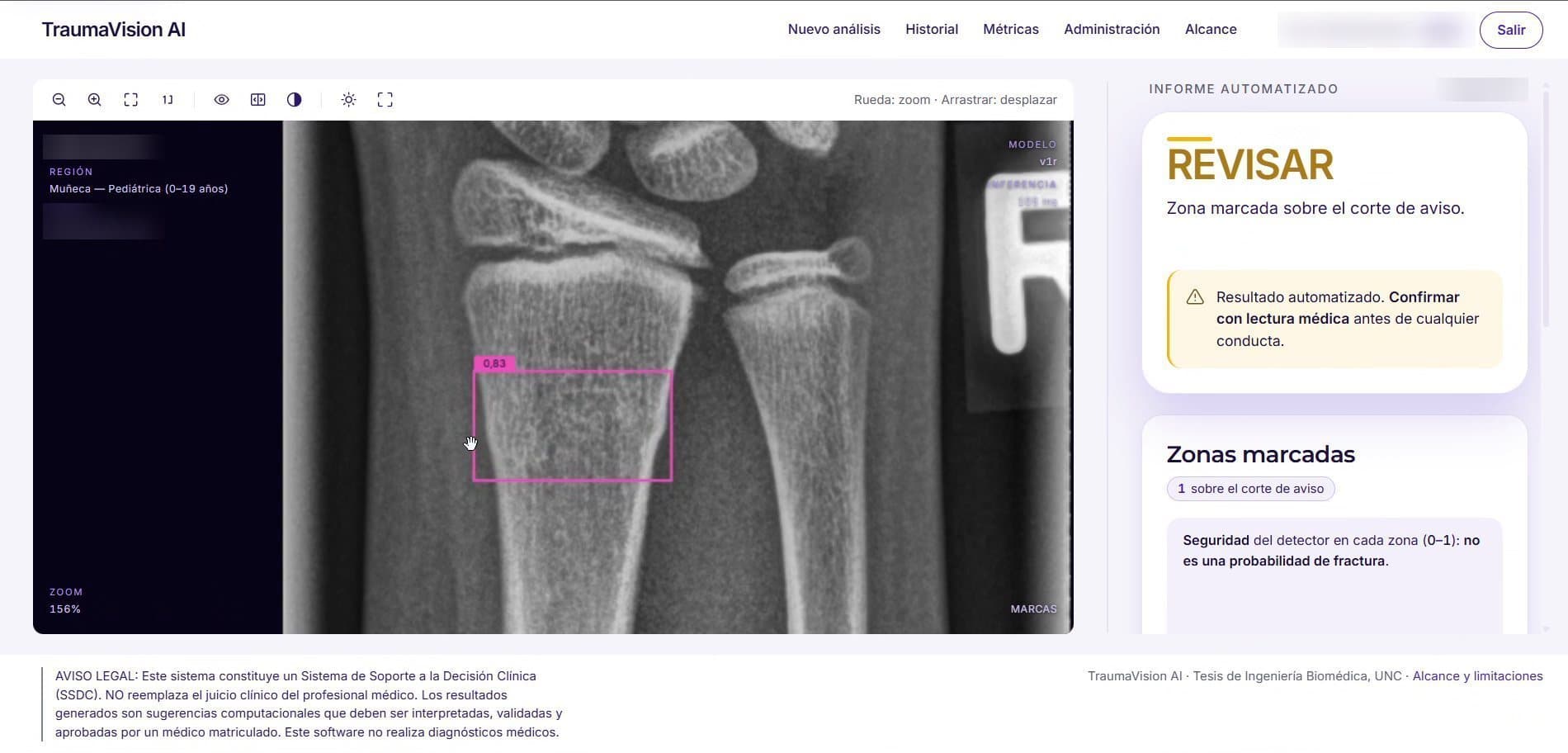 TraumaVision: REVIEW result, a zone marked over the distal radius with a 0.83 detector score and the notice to confirm with a medical reading