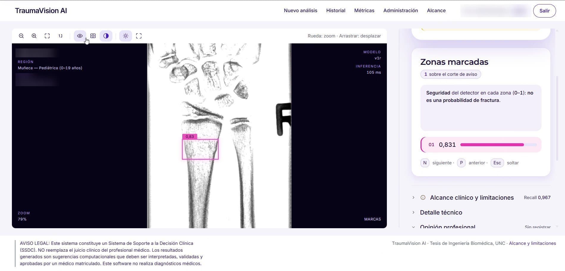 TraumaVision: viewer with inverted contrast and enhancement, the score bar per detection and the keyboard shortcuts